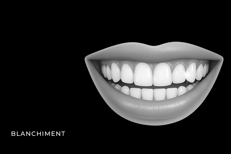 blanchiment